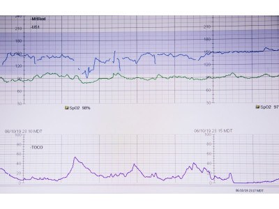 Scopri l'importanza del test di soglia nell'allenamento sportivo e come può aiutarti a progredire nella corsa, ciclismo e nuoto.