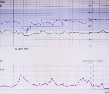 Tout savoir sur le test de seuil