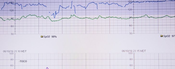 Tout savoir sur le test de seuil