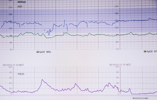 Discover the Importance of Threshold Testing in Sports Training: How It Can Help You Improve in Running, Cycling, and Swimming